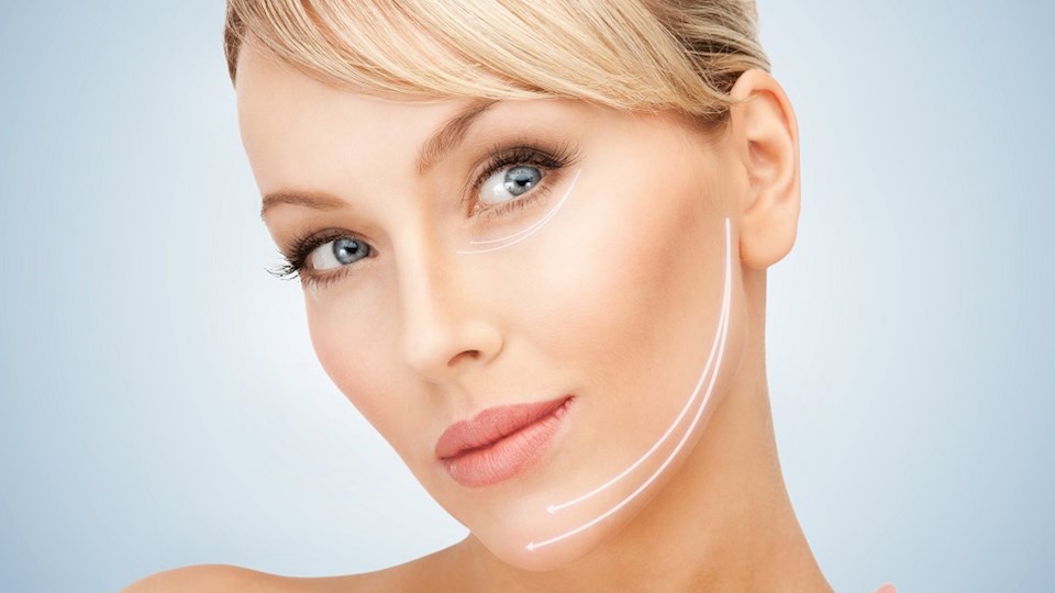 PDO Thread Lifts / Face Threading